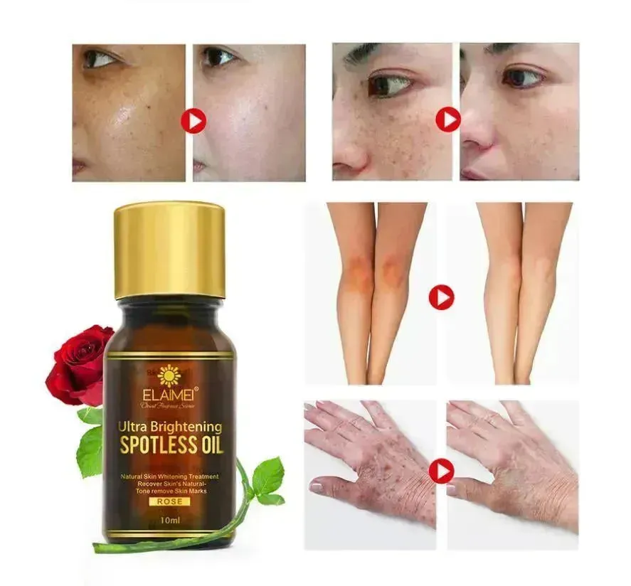 ELAIMEI Ultra Whitening Brightening Spotless Oil  Freckles and Dark Spot Remover